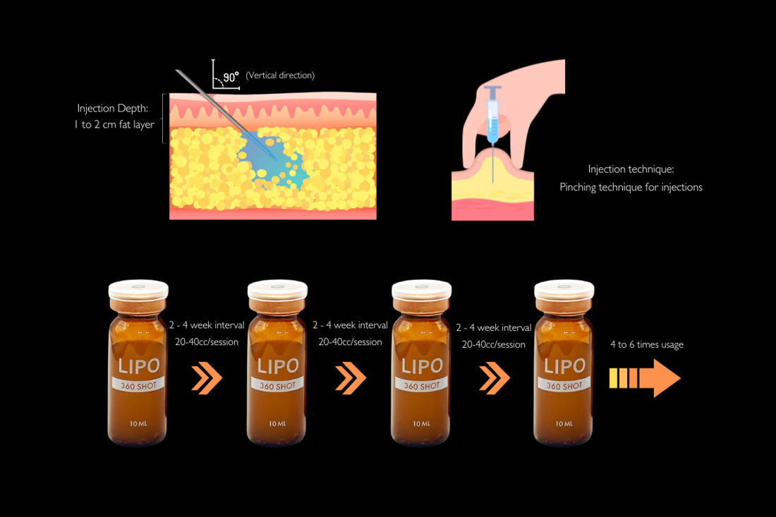 LIPO 360 SHOT treatment protocol diagram: injection depth of 1 to 2 cm into the fat layer at 90 degrees, pinching technique, 20 to 40 cc per session at 2 to 4 week intervals, 4 to 6 times usage